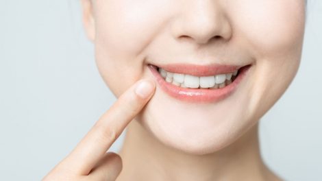 Fluorose: saiba tudo sobre o tema