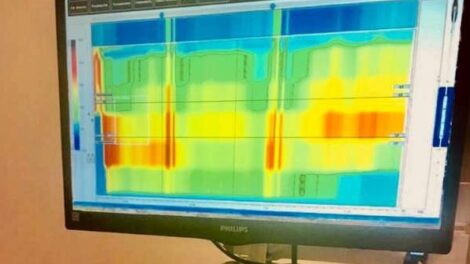 Curso Inovador de Manometria Anorretal Atrai Atenção no Rio de Janeiro