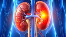 Cálculo Renal: Sintomas, Causas, Tratamentos, Cirurgias e Como Evitar Novas Pedras nos Rins